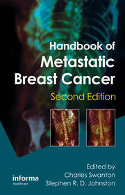 Handbook of Metastatic Breast Cancer book cover