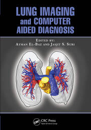 Lung Imaging and Computer Aided Diagnosis book cover