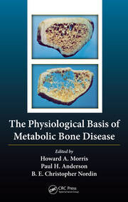 The Physiological Basis of Metabolic Bone Disease book cover