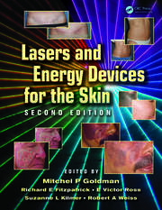 Lasers and Energy Devices for the Skin book cover