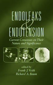 Endoleaks and Endotension: Current Consensus on Their Nature and Significance book cover