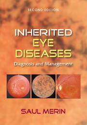 Inherited Eye Diseases: Diagnosis and Management book cover