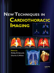 New Techniques in Cardiothoracic Imaging book cover