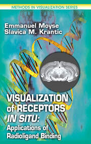 Visualization of Receptors In Situ: Applications of Radioligand Binding book cover