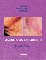 Facial Skin Disorders book cover