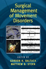 Surgical Management of Movement Disorders book cover