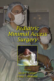 Pediatric Minimal Access Surgery book cover