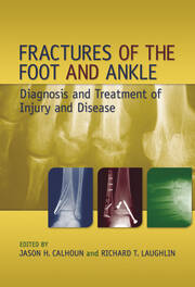 Fractures of the Foot and Ankle: Diagnosis and Treatment of Injury and Disease book cover