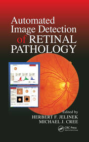 Automated Image Detection of Retinal Pathology book cover
