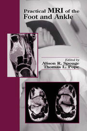 Practical MRI of the Foot and Ankle book cover
