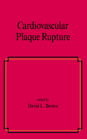 Cardiovascular Plaque Rupture book cover
