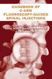 The Handbook of C-Arm Fluoroscopy-Guided Spinal Injections book cover