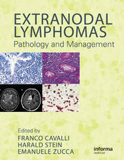 Extranodal Lymphomas: Pathology and Management book cover
