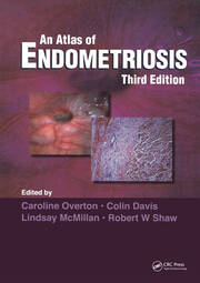 Atlas of Endometriosis book cover