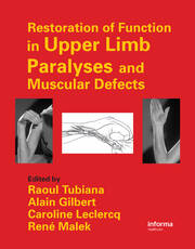 Restoration of Function in Upper Limb Paralyses and Muscular Defects book cover