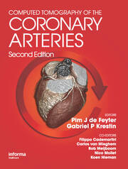 Computed Tomography of the Coronary Arteries book cover