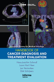 ESMO Handbook of Cancer Diagnosis and Treatment Evaluation book cover