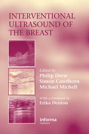 Interventional Ultrasound of the Breast book cover