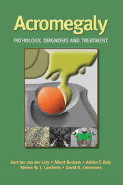 Acromegaly: Pathology, Diagnosis and Treatment book cover