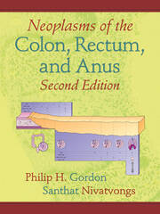 Neoplasms of the Colon, Rectum, and Anus book cover