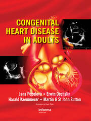 Congenital Heart Disease in Adults book cover