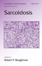 Sarcoidosis book cover