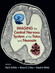 Imaging the Central Nervous System of the Fetus and Neonate book cover