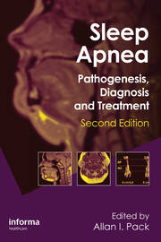Sleep Apnea: Pathogenesis, Diagnosis and Treatment book cover