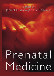 Prenatal Medicine book cover