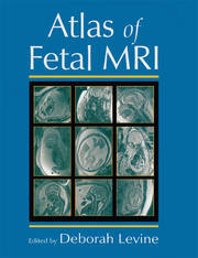 Atlas of Fetal MRI book cover