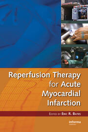 Reperfusion Therapy for Acute Myocardial Infarction book cover