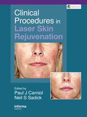 Clinical Procedures in Laser Skin Rejuvenation book cover