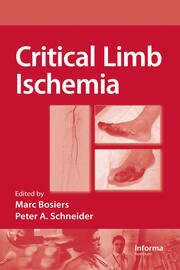 Critical Limb Ischemia book cover