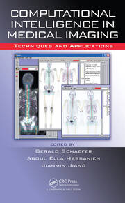 Computational Intelligence in Medical Imaging: Techniques and Applications book cover