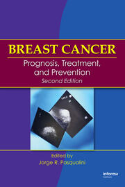Breast Cancer: Prognosis, Treatment, and Prevention book cover