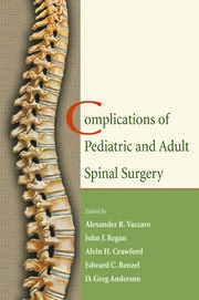 Complications of Pediatric and Adult Spinal Surgery book cover