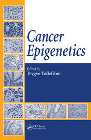 Cancer Epigenetics book cover
