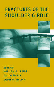 Fractures of the Shoulder Girdle book cover