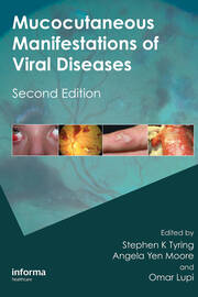 Mucocutaneous Manifestations of Viral Diseases: An Illustrated Guide to Diagnosis and Management book cover