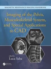 Imaging of the Pelvis, Musculoskeletal System, and Special Applications to CAD book cover