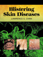 Blistering Skin Diseases book cover