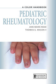 Pediatric Rheumatology: A Color Handbook book cover