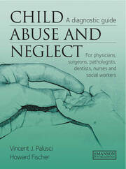 Child Abuse & Neglect: A Diagnostic Guide for Physicians, Surgeons, Pathologists, Dentists, Nurses and Social Workers book cover