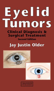 Eyelid Tumors book cover