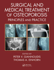 Surgical and Medical Treatment of Osteoporosis: Principles and Practice book cover