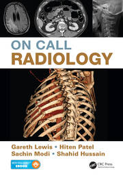 On Call Radiology book cover