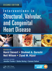 Interventions in Structural, Valvular and Congenital Heart Disease book cover