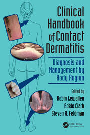 Clinical Handbook of Contact Dermatitis: Diagnosis and Management by Body Region book cover