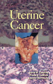 Uterine Cancer book cover
