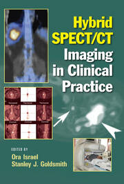 Hybrid SPECT/CT Imaging in Clinical Practice book cover